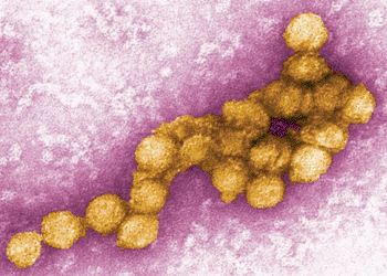 Imagen: Microfotografía electrónica de transmisión del virus del Nilo Occidental (Fotografía cortesía de Cynthia Goldsmith).